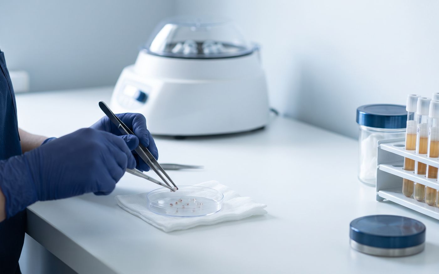Provette di PRP e innesti follicolari su un piano sterile in ambulatorio