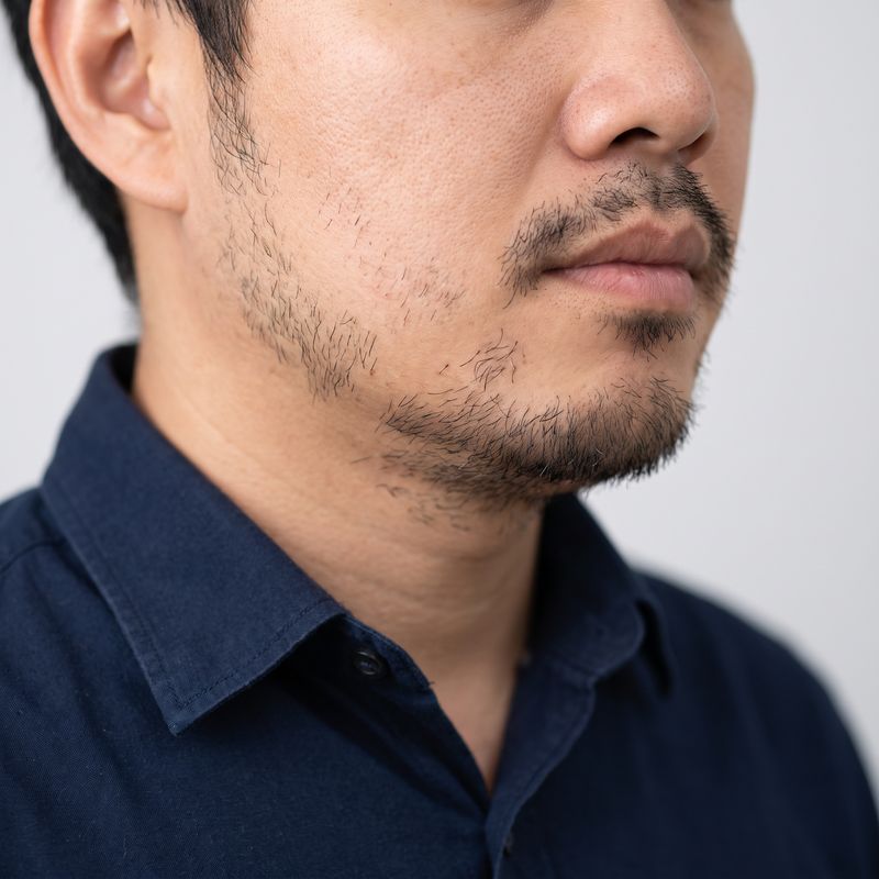 Cicatrice nella barba