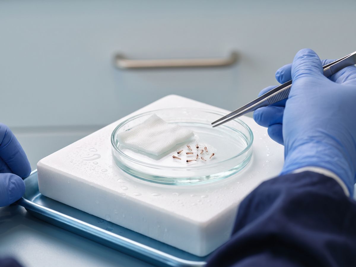 Micro-punch usato per prelevare gli innesti prima dell'impianto DHI