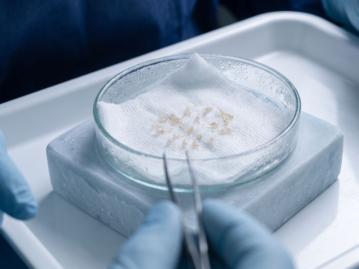 Innesti di capelli su garza refrigerata in attesa dell'impianto
